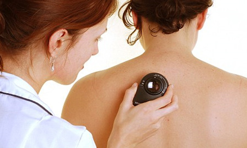 Skin Cancer Screening