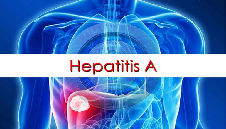 Hepatitis A