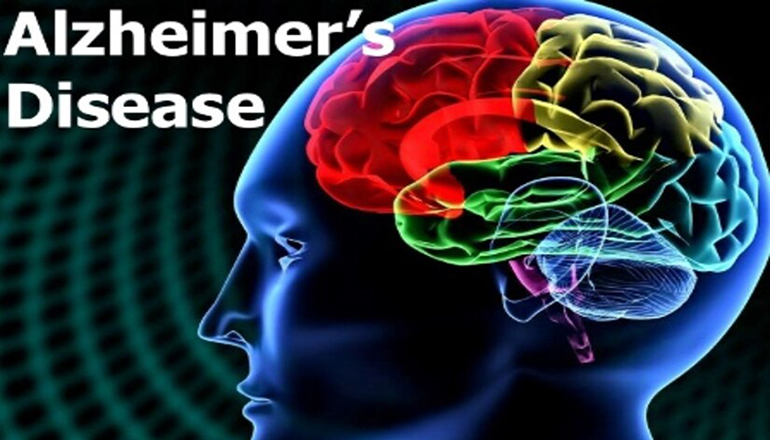 Alzheimers Disease News Graphic