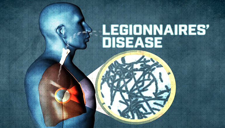 Legionnaires Disease