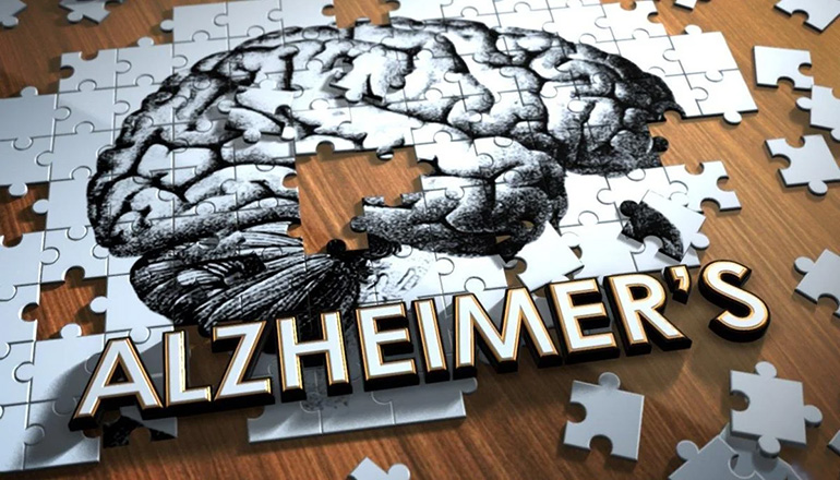 Alzheimers Disease news graphc