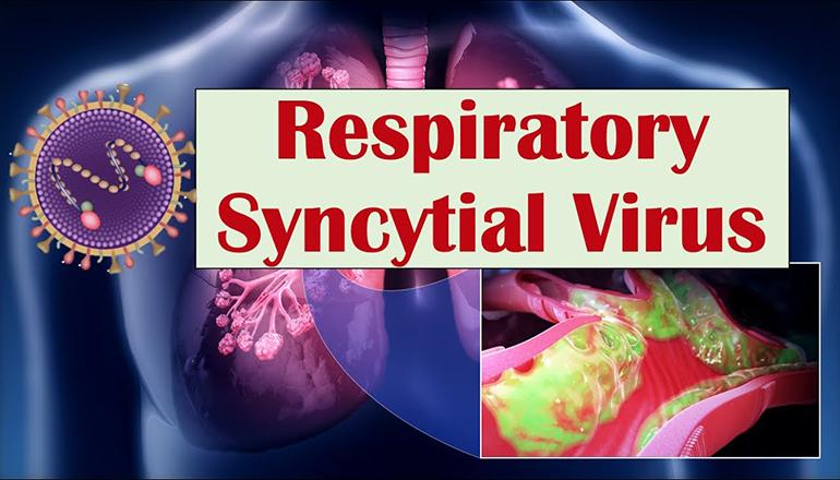 Respiratory Syncytial Virus News Graphic